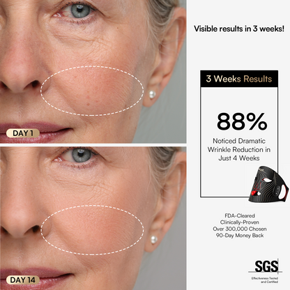 SORA Wireless Red Light Therapy Mask